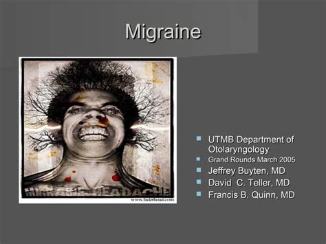 Migraine | PPT