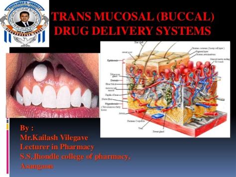 Transmucosal drug delivery by Kailash Vilegave