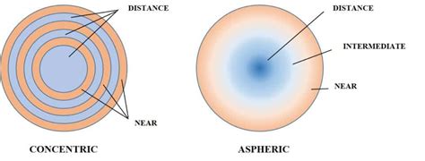 Multifocal Contact Lenses | Weber Vision Care