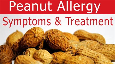 Peanut Allergy Food List