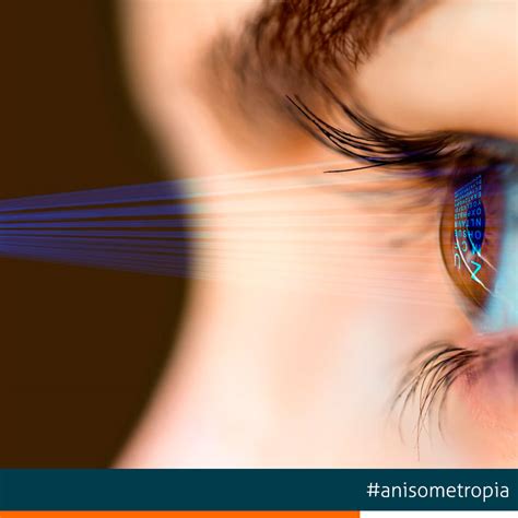 Anisometropía: Qué es, causas y tratamiento | Clinicas Tecnovision