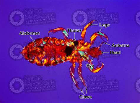 Pediculus humanus capitis. Head louse. Pediculosis. Ventral view - Lice - Insecta (Insects ...