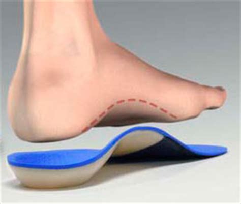 Custom Foot Orthotics - Orleans Integrative Medicine