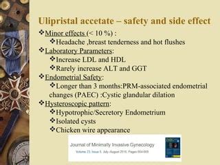 Ulipristal acetate in treatment of fibroids | PPT