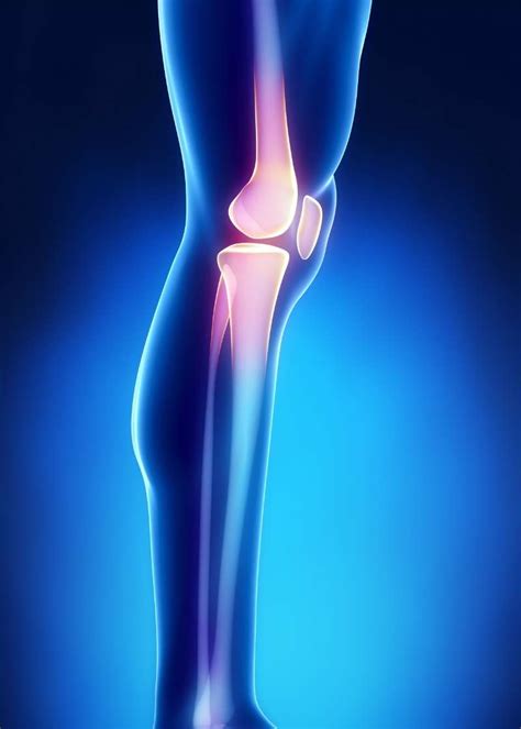 What is Patellofemoral Pain Syndrome? | Moyer Total Wellness