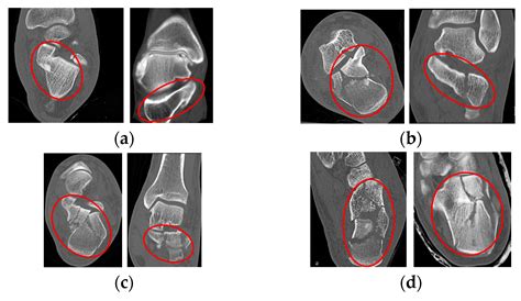 Applied Sciences | Free Full-Text | Real-Time Automated Segmentation and Classification of ...