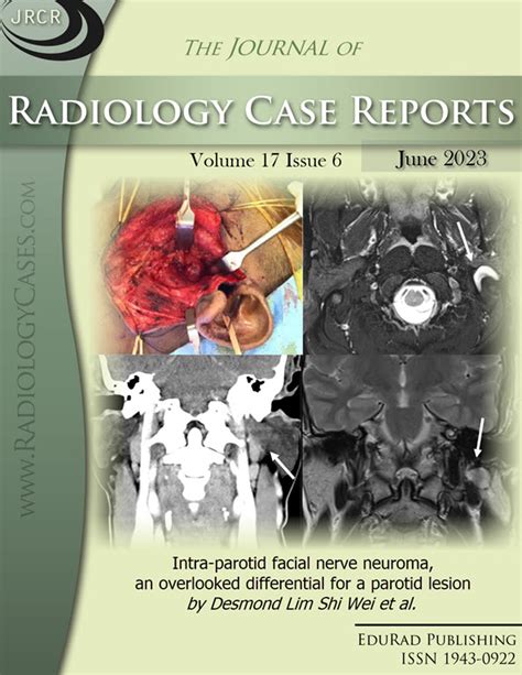 Journal of Radiology Case Reports