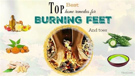 Top 14 Best Home Remedies For Burning Feet And Toes