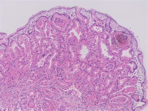 Parietal Cell Stomach Histology