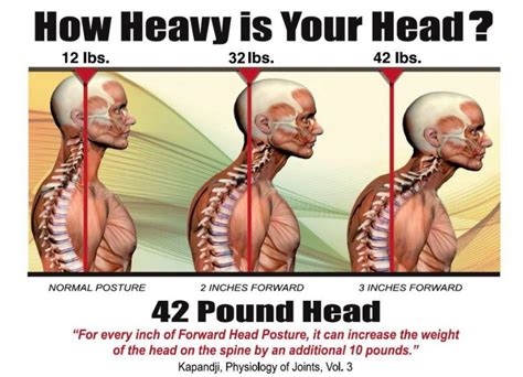 The True Cost of Bad Posture – South OC Chiropractic