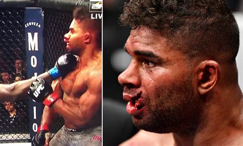 UFC star Alistair Overeem's suffers HORRIFYING facial injury after brutal punch | Daily Mail Online