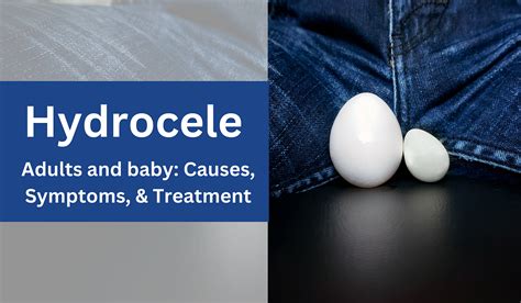 Hydrocele In Adults And Baby: Causes, Symptoms, And Treatment | by ...