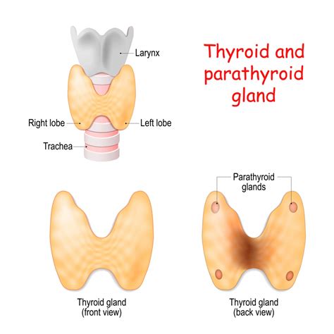 Enlarged Parathyroid Gland