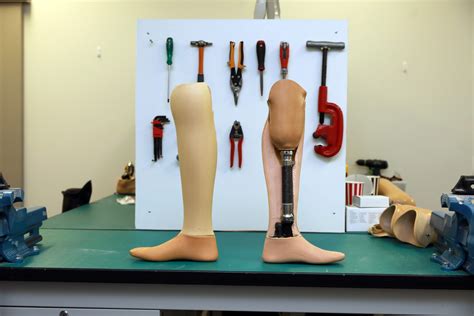 What Materials are used for Prosthetics? | APC Prosthetics