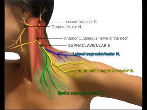 ULTRASOUND GUIDED SELECTIVE SUPRACLAVICULAR NERVE BLOCK - YouTube