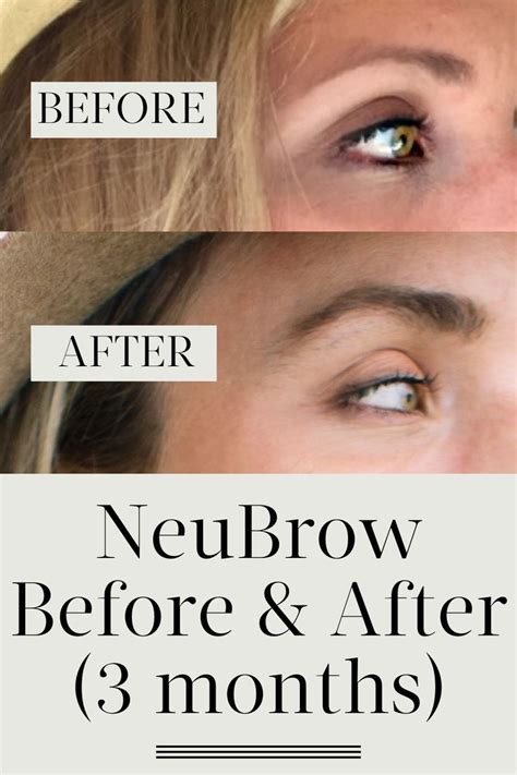 My neuBROW Before and After Pictures + The 5 Best Brow Growth Serums in 2020 | Brow growth serum ...