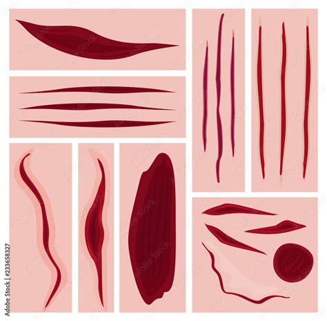 Vector illustration set of cuts, scars, bruises and slaughter. Bloody ...