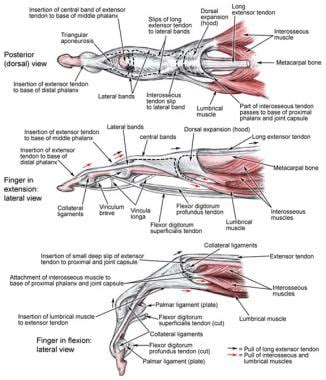 Metacarpophalangeal Joint Ligaments