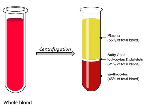 Blood plasma - HORIBA