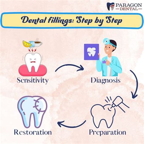 Different Types of Dental Fillings