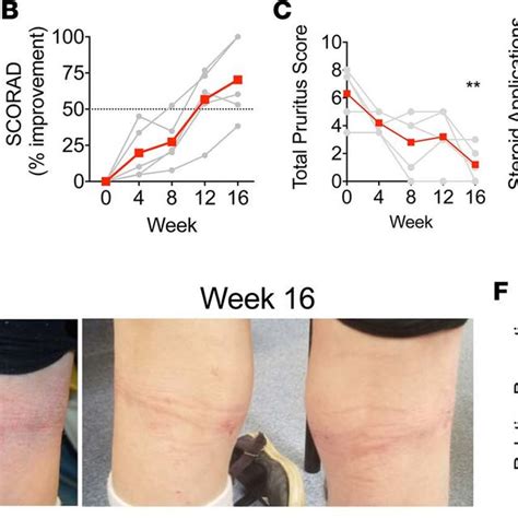 Topical Roseomonas mucosa shows activity against atopic dermatitis in... | Download Scientific ...