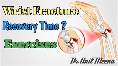 wrist fracture recovery time | Colles fracture recovery time | wrist ...