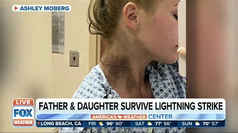 Lightning Strike Survivors Recall Terrifying Moment They Were Hit In FL Parking Lot - YouTube