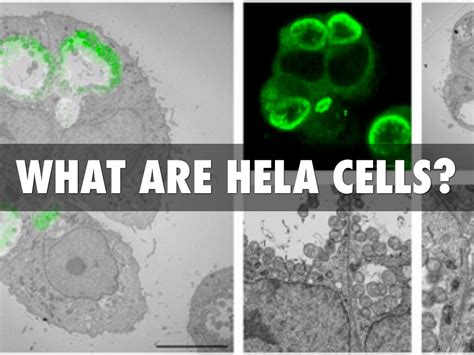 What Are HeLa Cells? by Audra Hawley