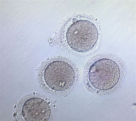 The Incredible Human Egg - Fertility Answers - Lafayette - Baton Rouge