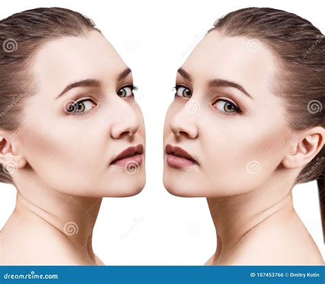 Female Nose before and after Cosmetic Surgery Stock Photo - Image of comparison, makeup: 107453766