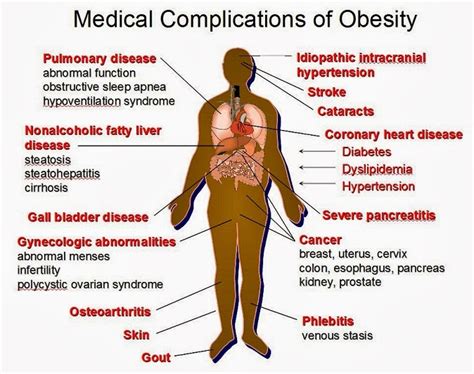 Facts Fun: OBESITY AND HOME REMEDIES