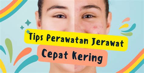 Tips Perawatan Wajah Berjerawat Cepat Kering Bersama SCA