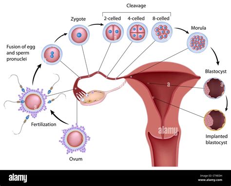 Implantation Diagram