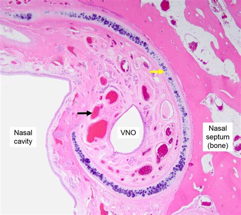 Air conduction: Nasal cavity, Paranasal sinuses, and Vomeronasal Organ – Veterinary Histology