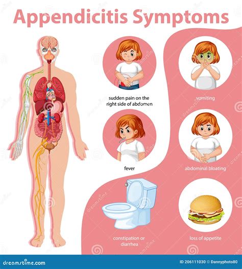 Symptoms Of Appendicitis: Constipation, Fever, Vomiting, Flatulence ...