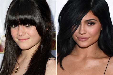 Kylie Kardashian Before And After