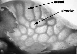 Photograph of a Ctenomys tympanic bulla showing, by transparence, the... | Download Scientific ...