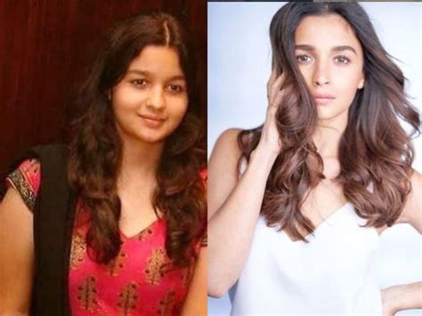 Alia Bhatt transformation | These before-after photos of Alia Bhatt's ...