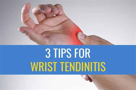 3 Tips for treating Wrist Tendinitis caused by computer work | Sports ...