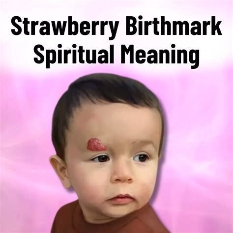 Know Strawberry Birthmark Spiritual Meaning