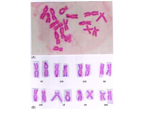 (A) Diploid metaphase chromosome; and (B) its karyotype from the root... | Download Scientific ...