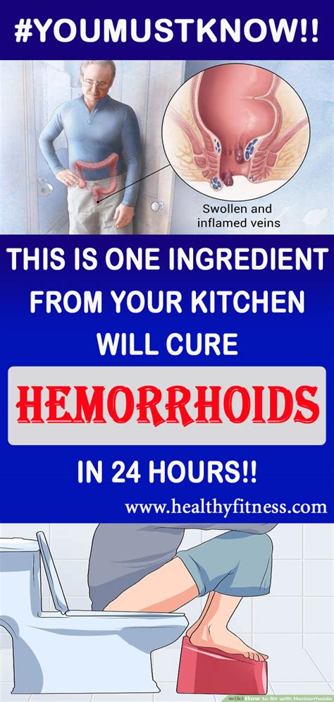 THIS SIMPLE REMEDY CAN CURE YOUR HEMORRHOIDS IN JUST 20 MINUTES !!! - world of health