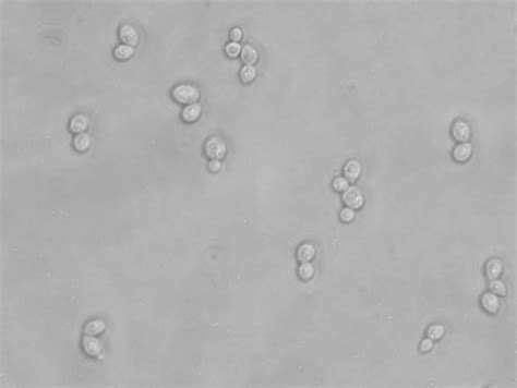 Budding yeast | Budding yeast (Saccharomyces cerevisiae), gr… | Flickr