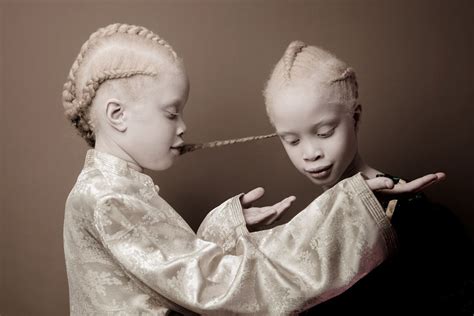 Albino Twins From Brazil Are Challenging The Fashion Industry With ...