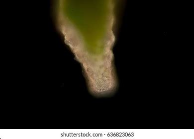 Difflugia Spprotozoa Under Microscope Stock Photo 636823063 | Shutterstock