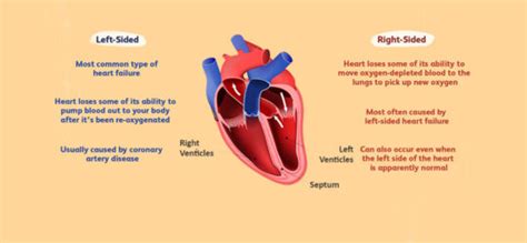 Left Sided Heart Failure, Causes, Symptoms and Treatment | Dr. Raghu