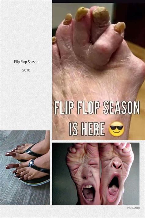 Flip Flop Season is here... | Flop, Seasons, Flip flops