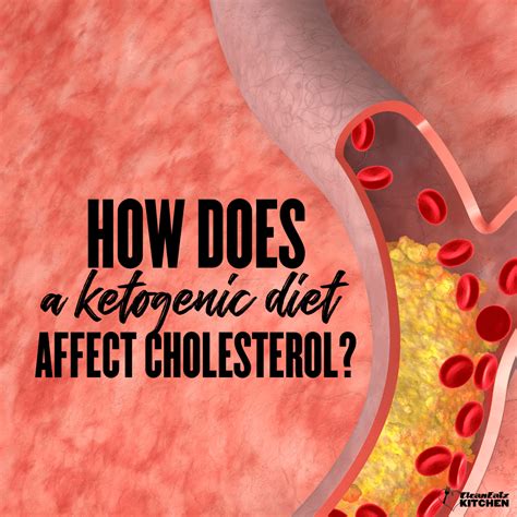 How Does Keto Diet Affect Cholesterol? Key Insights