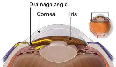 Iridocorneal Angle