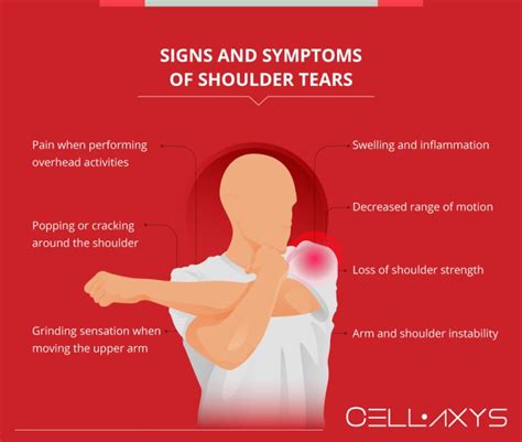 Shoulder Labrum Tears: Treatment And Diagnosis - Cellaxys